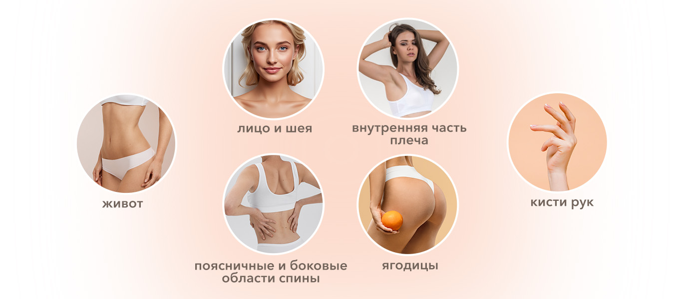 Виды мезонитей для различных зон