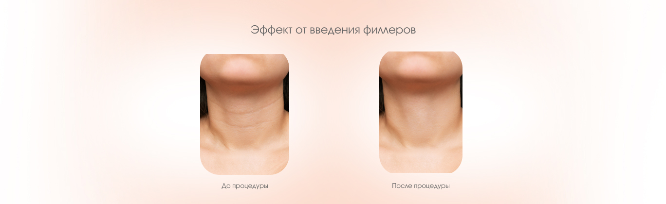 Результаты