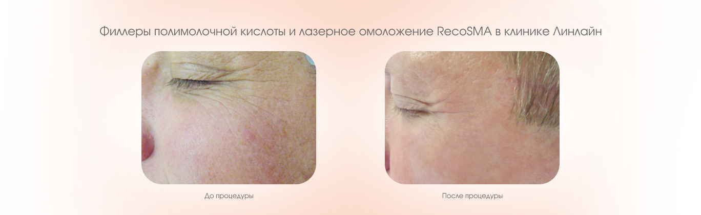 Процедуры