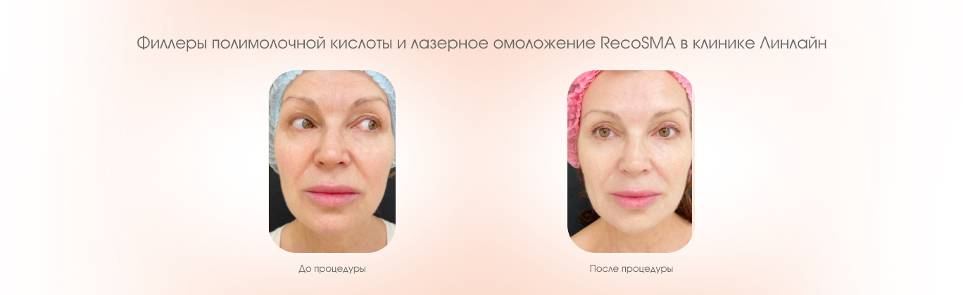 Процедуры