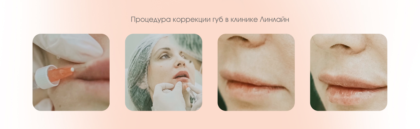 Процедура