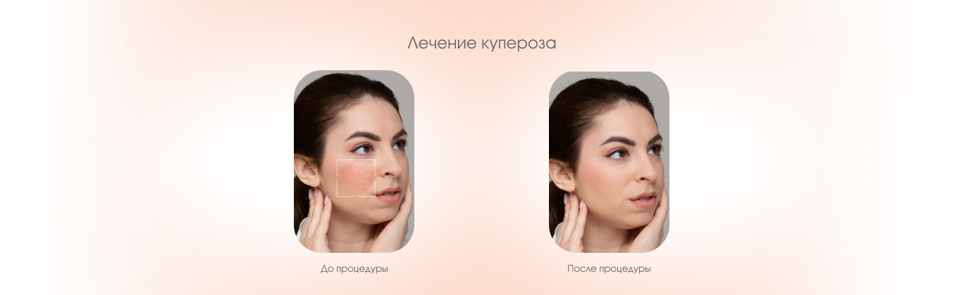 Результаты