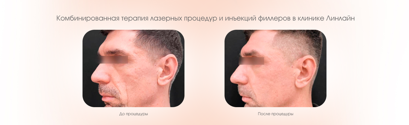 Процедуры