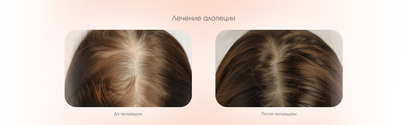 Результаты