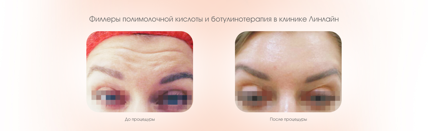 Процедуры