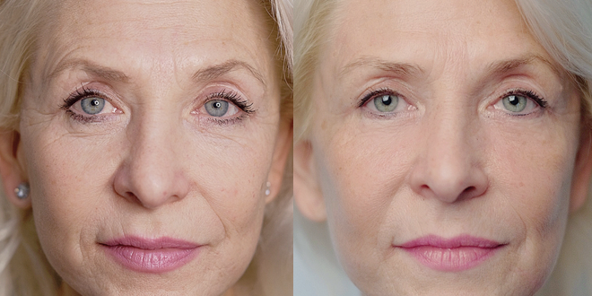 RecoSMA: бьюти-интенсив RecoSMA: бьюти-интенсив