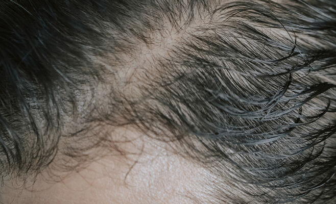 Восстановление волос до процедуры