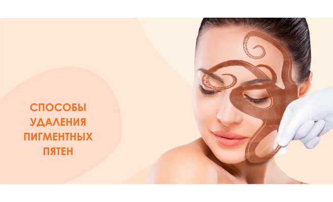 Пигментация: что знать, чтобы её победить?