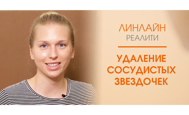 Удаление сосудистых звездочек лазером Удаление сосудистых звездочек лазером