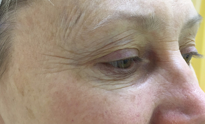 До