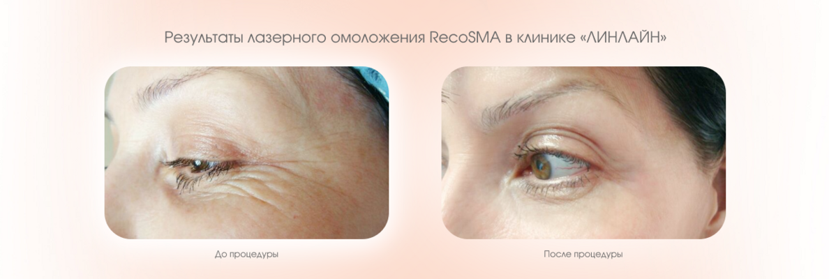 21ec0910-68bf-44f4-8b9c-7f3e364cf205.png