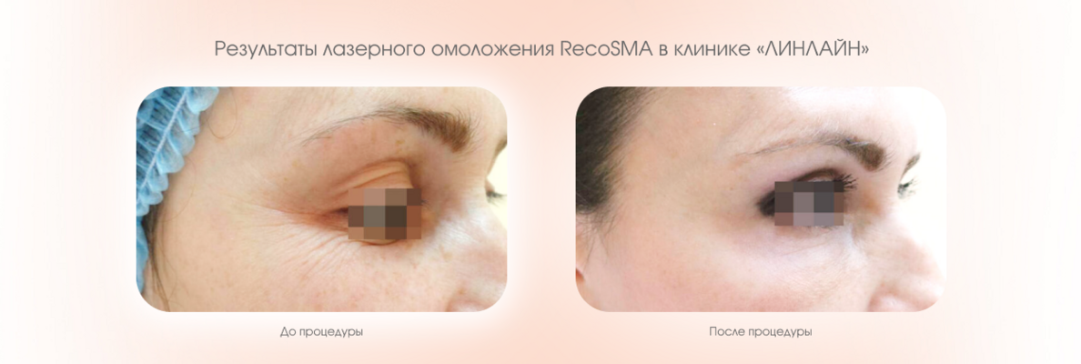 57aed0bc-486f-45c3-adba-8275eb467718.png