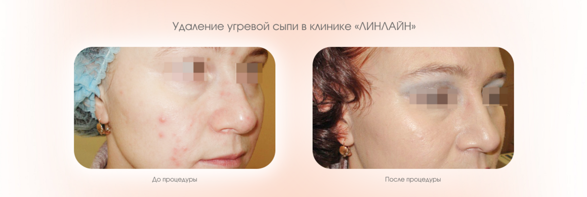 a3fe6899-d6dc-40f5-81ee-44e3a147e23c.png