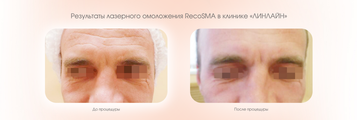 a956ca26-7e77-4bea-ab83-92b9f18f2db0.png