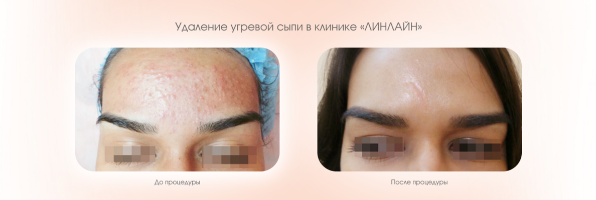 c703d79f-f5cd-4a8a-949d-a2e1d388d48b.png