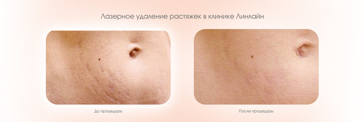 fe29091b-01c0-4984-be20-cb8e5f13de99.jpg