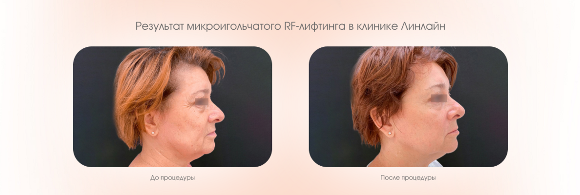 e37172b7-2f83-427c-9740-53b43dade421.png