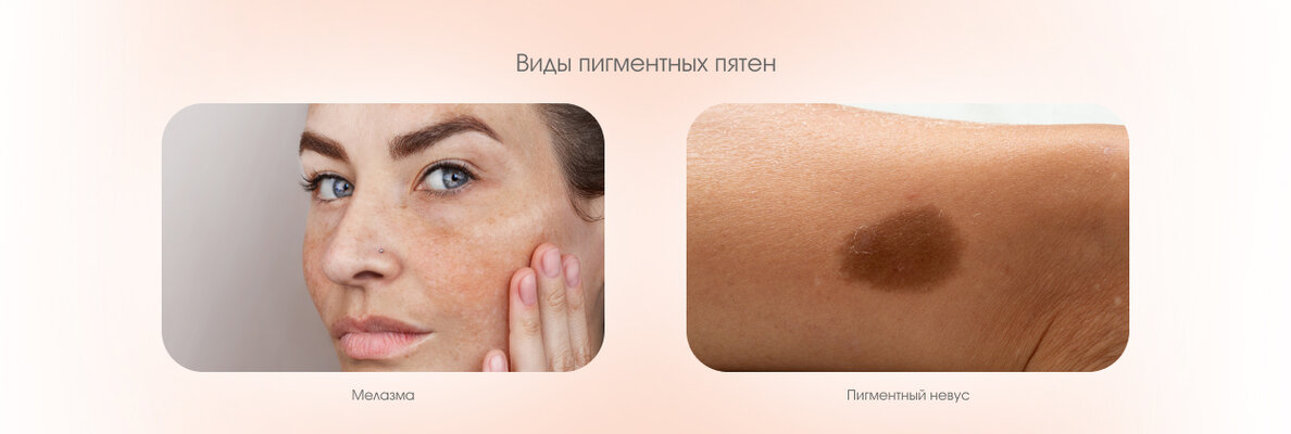 5ab6202f-5bcf-4cd5-84b3-800709a44eff.jpg