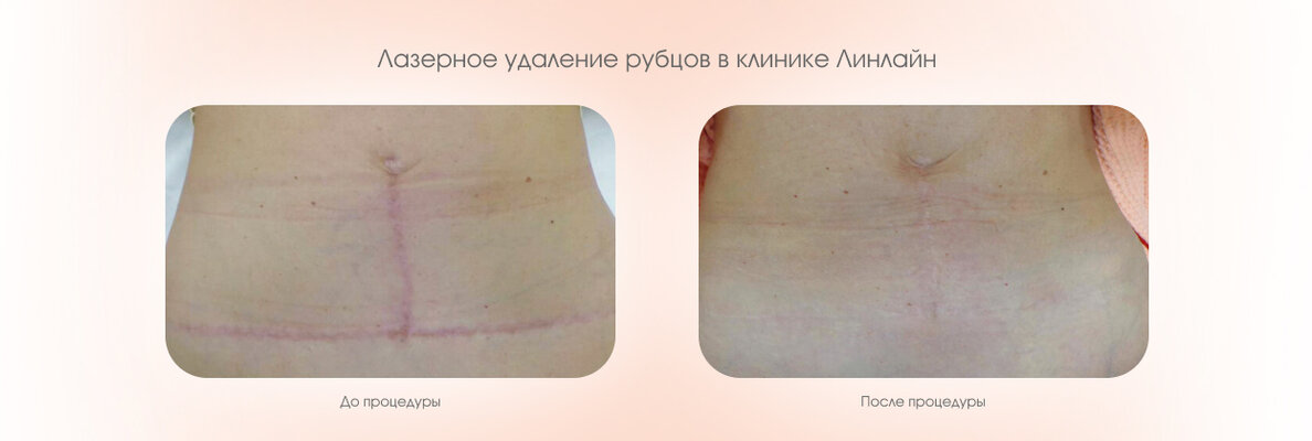 fa350e4f-4aa3-41c0-85d0-3bf634165296.jpg