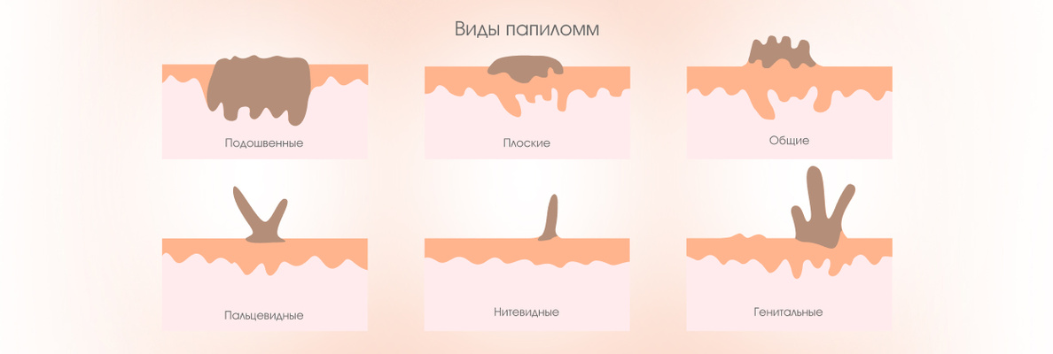 f1e11bfd-0abd-479e-8213-f39fd0410304.jpg