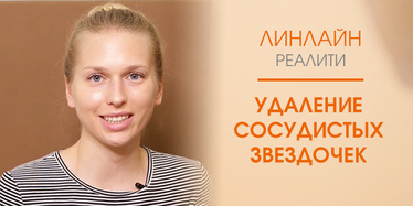 Удаление сосудистых звездочек лазером Удаление сосудистых звездочек лазером