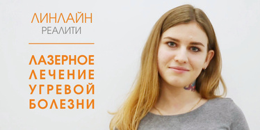 Лечение угревой болезни лазером. Проект ЛИНЛАЙН-реалити Лечение угревой болезни лазером. Проект ЛИНЛАЙН-реалити