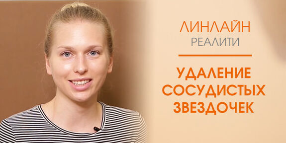 Удаление сосудистых звездочек лазером Удаление сосудистых звездочек лазером